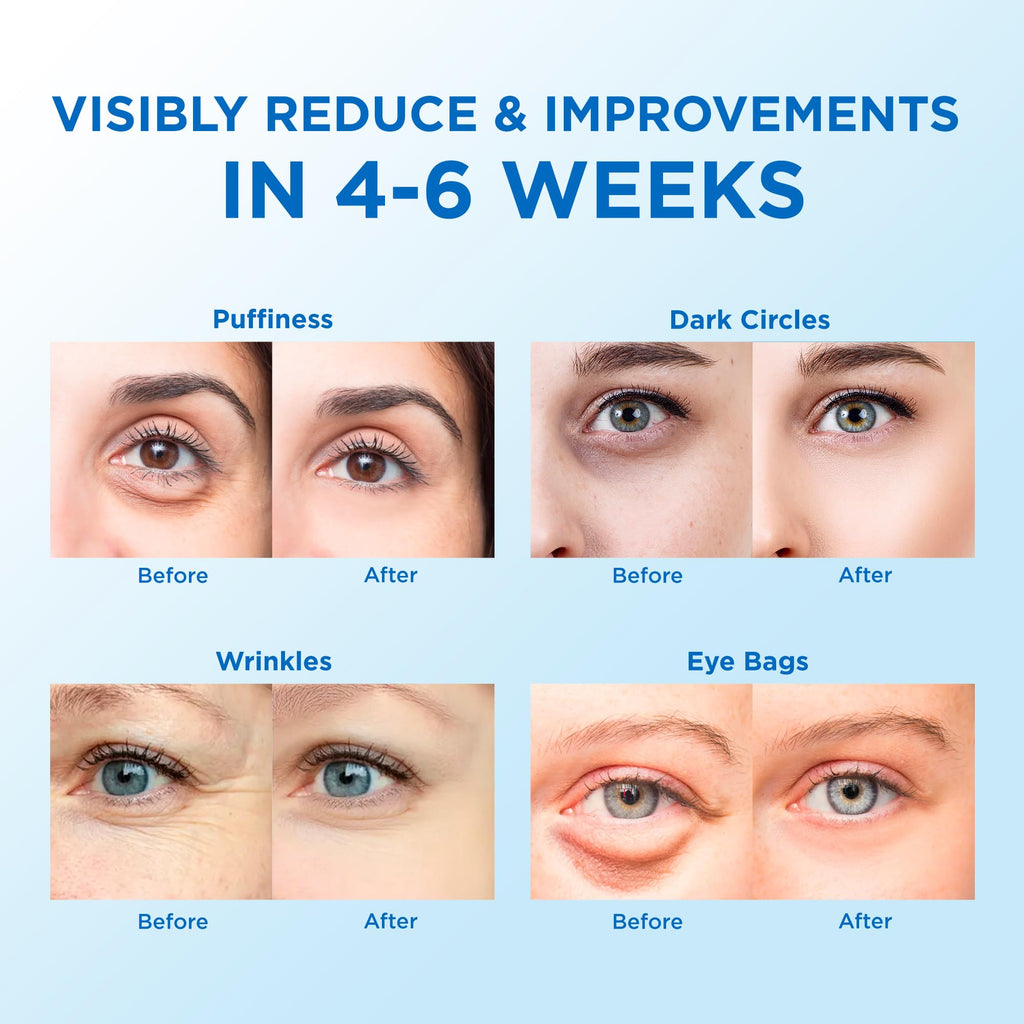Zelens HydroBright™ — Advanced Eye Treatment Patches (120pcs)